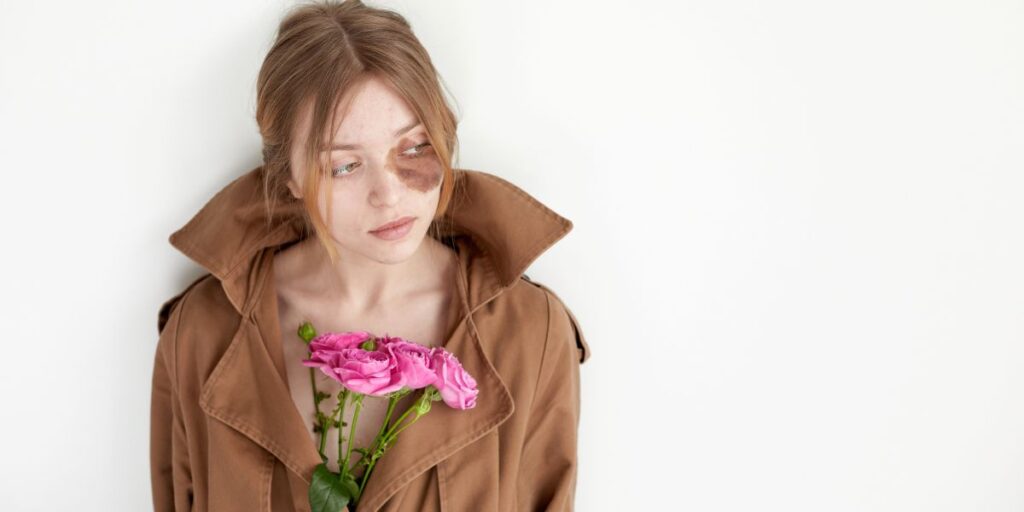 How Do I Treat Hyperpigmentation With Skincare? How Do I Treat Hyperpigmentation With Skincare?